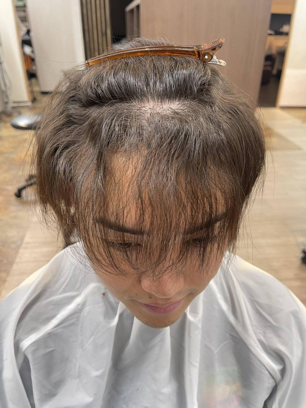 【ビフォーアフターをご紹介】